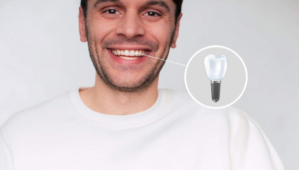 implant dentar București